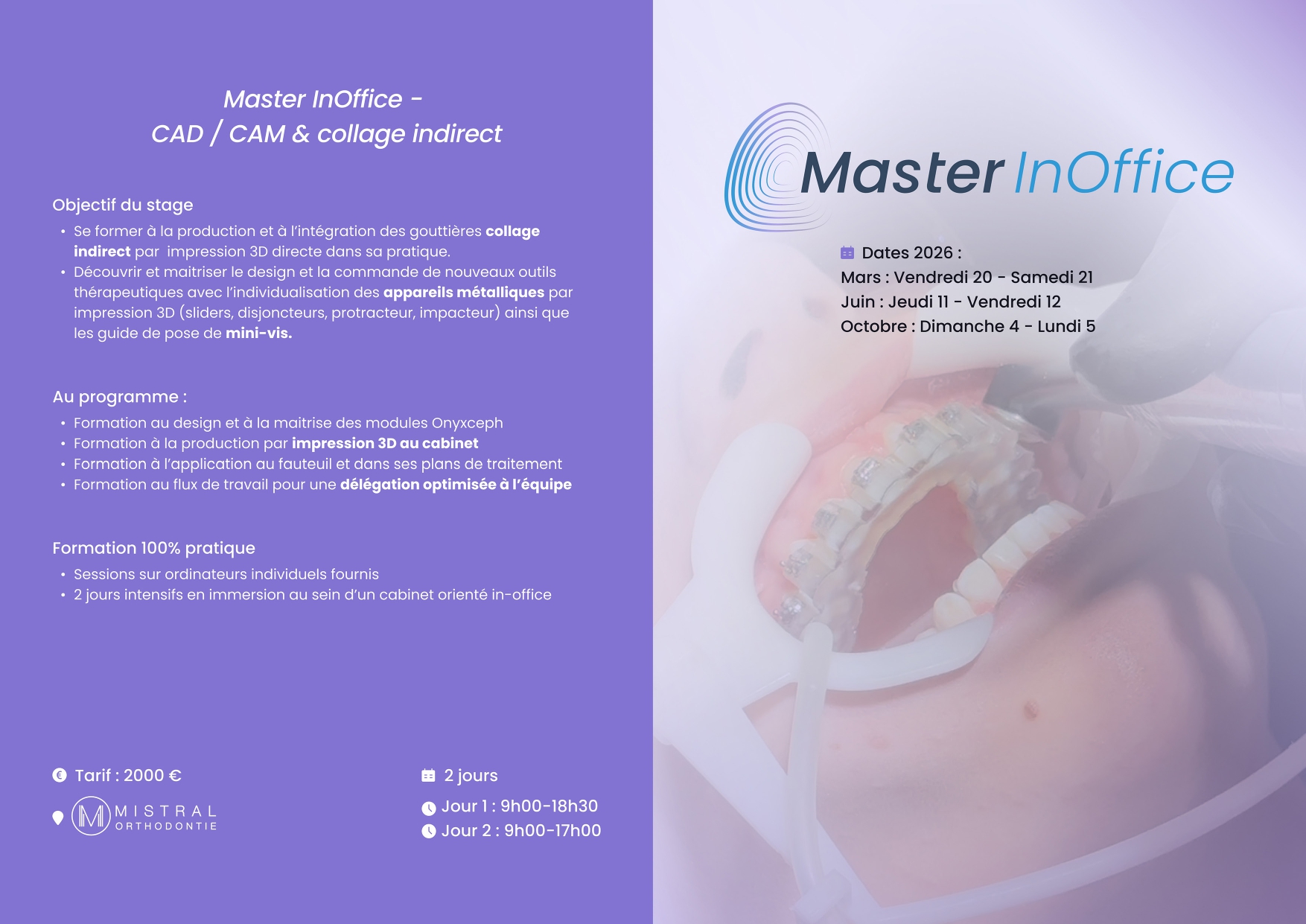 Formation CAD / CAM collage indirect